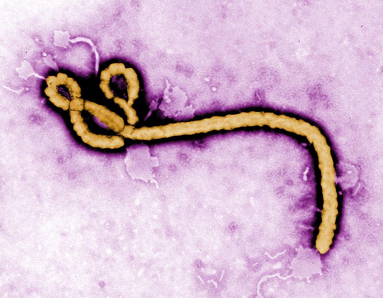 Health Advisory: Outbreak of Ebola Virus Disease (Sudan ebolavirus) in Uganda